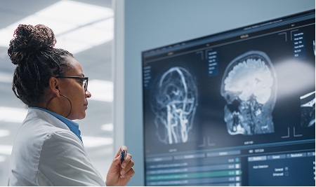 Doctor reviewing brain MRI scans on a monitor